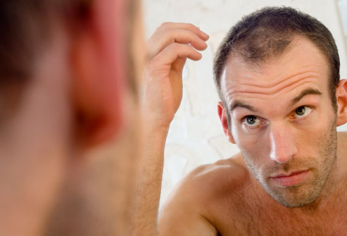 HAIR LOSS IN MEN - Hair Transplant Turkey